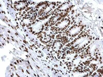 Immunohistochemistry-Paraffin: HIST1H3A [ac Lys18] Antibody [NBP2-43535]